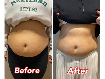 美波整体院 矢巾院/フォースカッターbefore→after