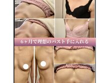 サチ(Sachi)の雰囲気（【本気で悩む人しか施術しません】2～3カップUPバストアップ術）