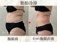 ウィボーテ(We Beaute)の写真/今話題の＜脂肪冷却＞×＜針を使わない脂肪分解＞×＜ラジオ波＞の組み合わせ施術でアプローチ◎【痩身】