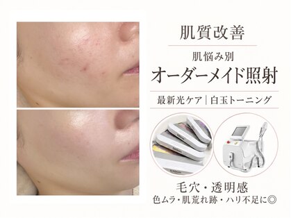 ラシク(LASHIQ)の写真