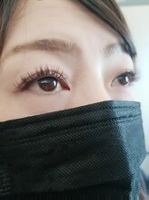 アミークス(Amicus)/