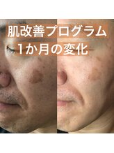 ストック(stock)/シミはあきらめないで！