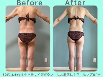 ビーナイス ビューティー(Be Nice Beauty)/巡りがよくなった証拠　(^-^)/