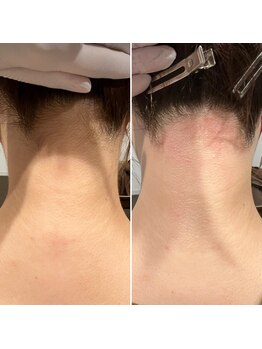 メローワックス 松本駅前店(MELLOW WAX)/before after