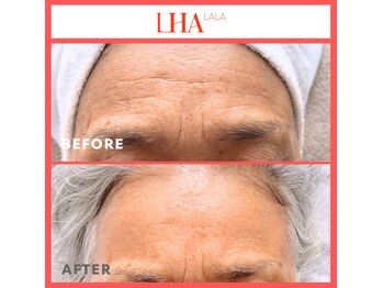 ビーンズ(BEANS)/ララピール