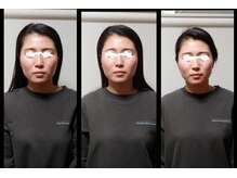 美容整体ナチュラル(natural)の雰囲気（顔だけでなく、全身からアプローチすると更に小顔に！）