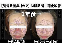 サロンスペース/50代女性　AI肌診断 1年後