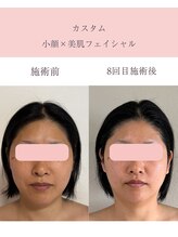 シンナリ(Shinnari)/カスタム小顔×美肌フェイシャル