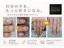 スノー(SNOW)