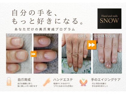 スノー(SNOW)の写真