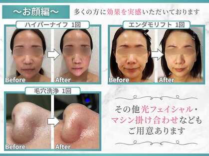 イデアルボーテの写真