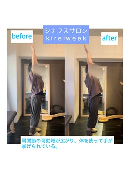 きれいウィーク 恵比寿/肩関節施術before、after