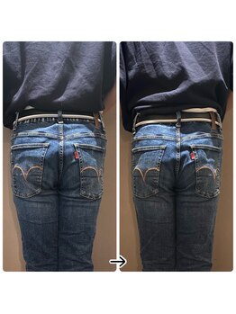 ブラックスワン(Black Swan)/