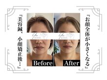 鍼灸整体院ユー(鍼灸整体院You...)/before/after