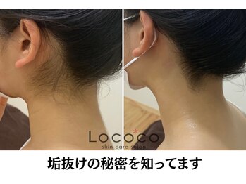 ロココ 山口店(Lococo)/産毛ないだけで垢抜け120%！