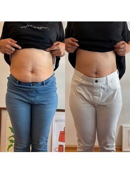 ドゥードル(doodle)/