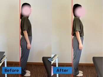 鈴家/姿勢矯正/ビフォー/アフター