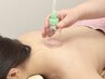【産後6か月以内のママさん】カッピング40分　慢性的な首肩こりの方★お勧め