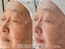 シファ(Sifa.)/ホワイトスノーピール