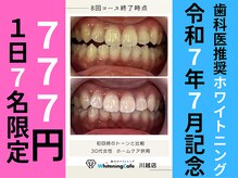 ホワイトニングカフェ 川越店