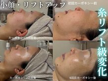 ハニエル(Haniel)の雰囲気（小顔・リフトアップしたい方必見☆驚愕レベルの結果をお届け♪♪）