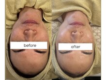 クレール 小山店(CLAIR)/【美肌フォト+エレポレ】