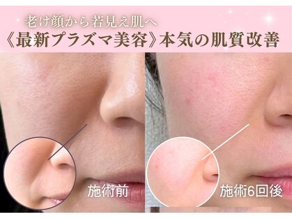 ヴィアス(VIAS)の写真