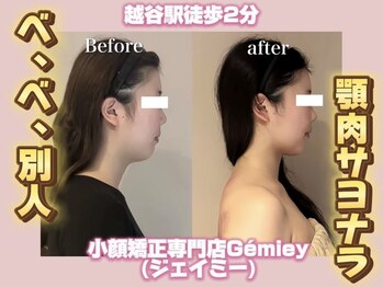 ジェイミー(Gemiey)/みんなびっくりな垢抜け！！
