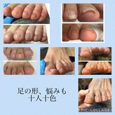 フッティーナ ナースプラス(フッティーナNs+)