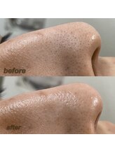 毛穴専科/毛穴洗浄+白玉ワックス メンズ◎