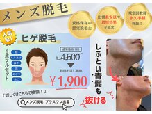トレース