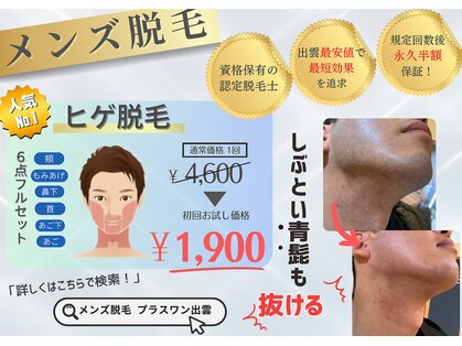 トレースの写真