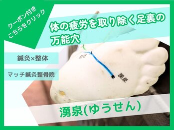 マッチ鍼灸整骨院/鍼灸＆整体で疲労も解消！