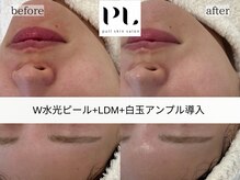 プルスキンサロン 大阪店(pull skin salon)/