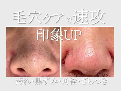 メンズフェイス 刈谷店の写真