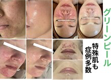 パームボーテ(Palm Beaute)