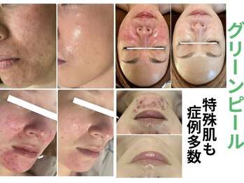 パームボーテ(Palm Beaute)