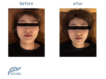 リアルボイス(REAL VOICE)の写真
