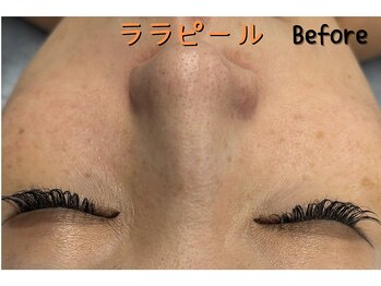 ダイヤモンド リーエンダ(Diamond leende)/ララピール