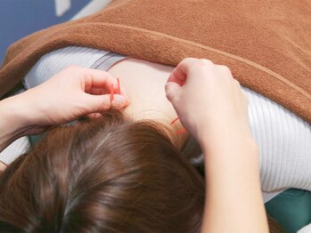 越谷ヘルム鍼灸整体院(越谷HELM鍼灸整体院)の写真/【効果抜群★】慢性痛には《整体＋鍼灸》で根本にアプローチ！今よりもっと美しくなりたい方には《美容鍼》