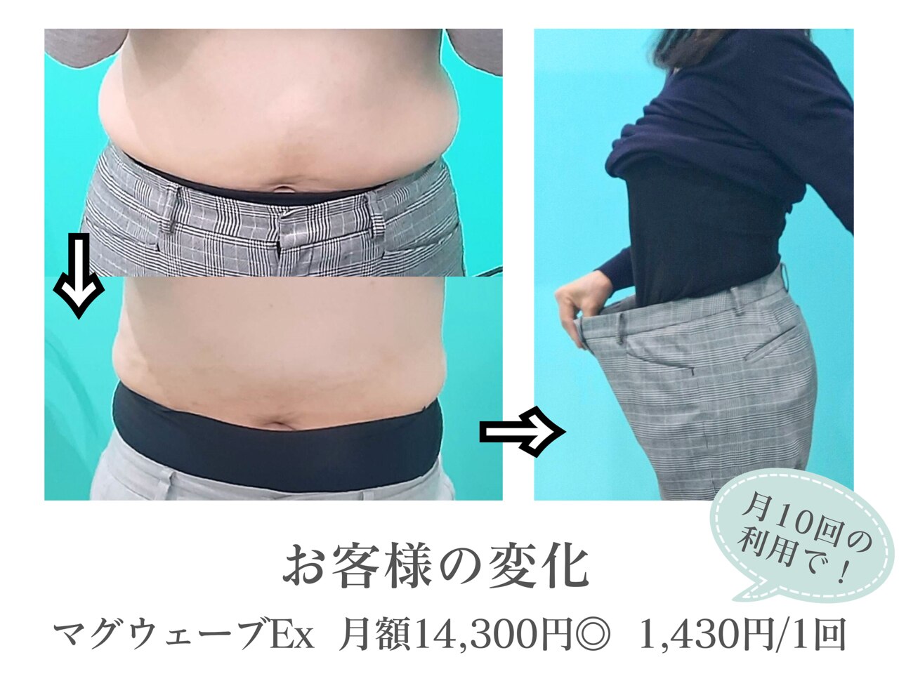 電磁パルス痩身　MAGWAVE EX 骨盤底筋トレーニング 楽天市場】【送料無料】電磁パルステスラシェイプ[ハンドピース4