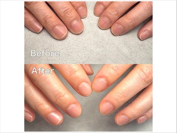 マニネイルケア 府中店(maninail CARE)/ビフォーアフター