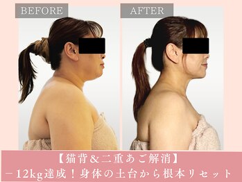サロン ド リアン(salon de lien)/後ろ姿美人＆若々しい横顔へ