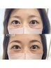 【眉毛スタイリング】アイブロウデザインWAX脱毛★間引き/眉トリートメント付