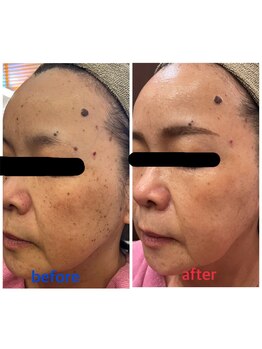 ワールドアイ(World. I)/肌質改善