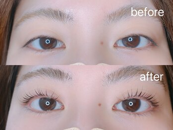 ウィンジュリー(Winjury)/似合わせパーマ