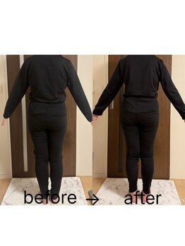 ヨサパーク ラウレアボディ 昭島店(YOSA PARK Laule'a Body)/お客様のbefore/after