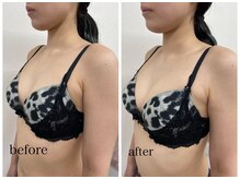 ロザリア(ROSALIA)の雰囲気（『美姿勢＆バストアップ効果』20～30代の女性に選ばれています☆）