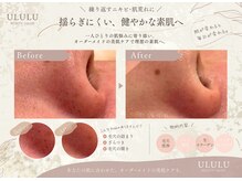 ウルル 名古屋駅前店(ULULU)の雰囲気（【大人気の毛穴洗浄!!】ちゅるっとお肌でメイクのり抜群★）