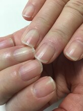 ディアネイル(Dear Nail)/ネイルケア